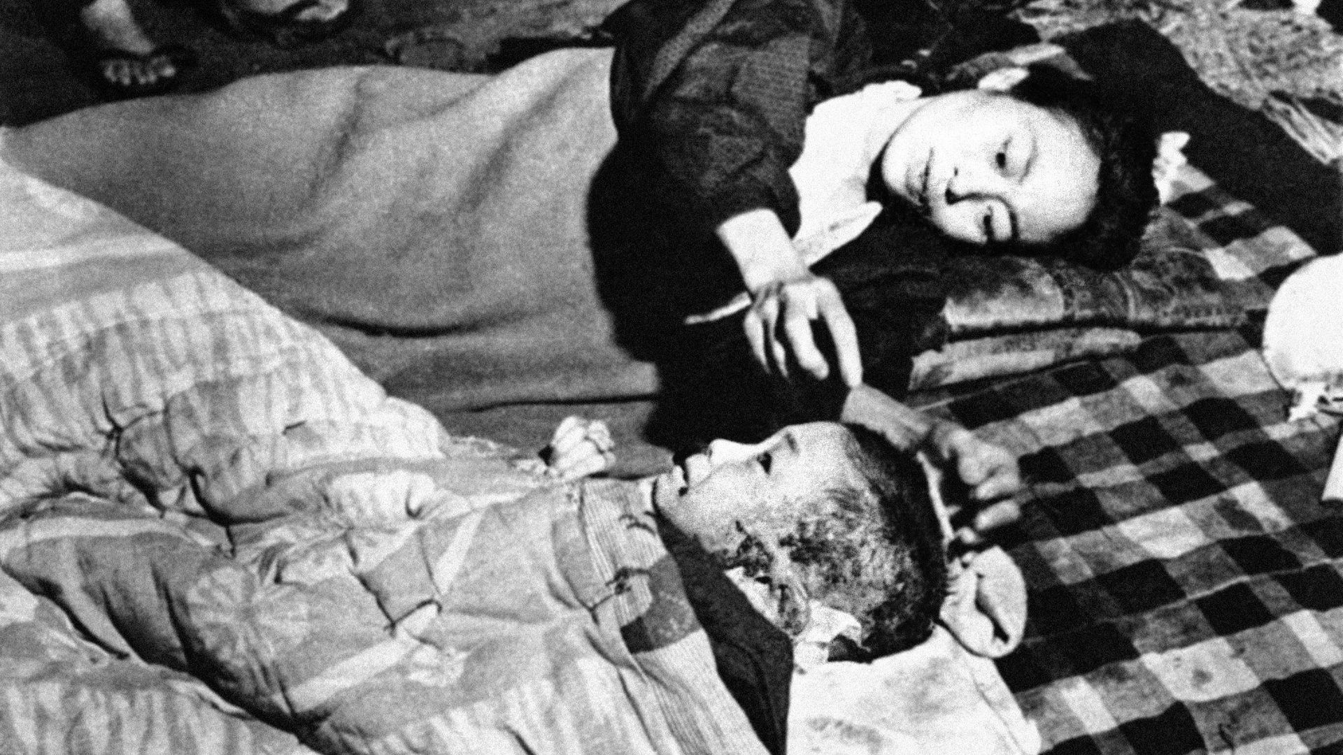 Жертвы атомной бомбардировки Хиросимы, 6 октября 1945 Жертвы атомной бомбардировки Хиросимы, 6 октября 1945 - РИА Новости, 1920, 17.05.2023
