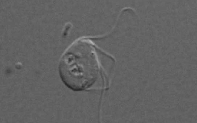 Микрофотография эукариоты Monocercomonoides Микрофотография эукариоты Monocercomonoides