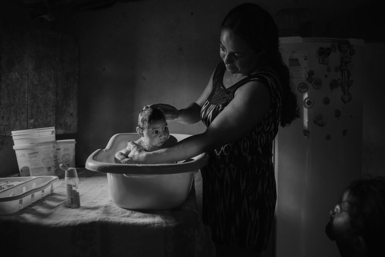 Victims of the Zika Virus фотографа Lalo de Almeida занявшего второе место в категории Проблемы современности в фотоконкурсе World Press Photo Victims of the Zika Virus фотографа Lalo de Almeida занявшего второе место в категории Проблемы современности в фотоконкурсе World Press Photo