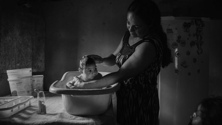 Victims of the Zika Virus фотографа Lalo de Almeida занявшего второе место в категории Проблемы современности в фотоконкурсе World Press Photo Victims of the Zika Virus фотографа Lalo de Almeida занявшего второе место в категории Проблемы современности в фотоконкурсе World Press Photo