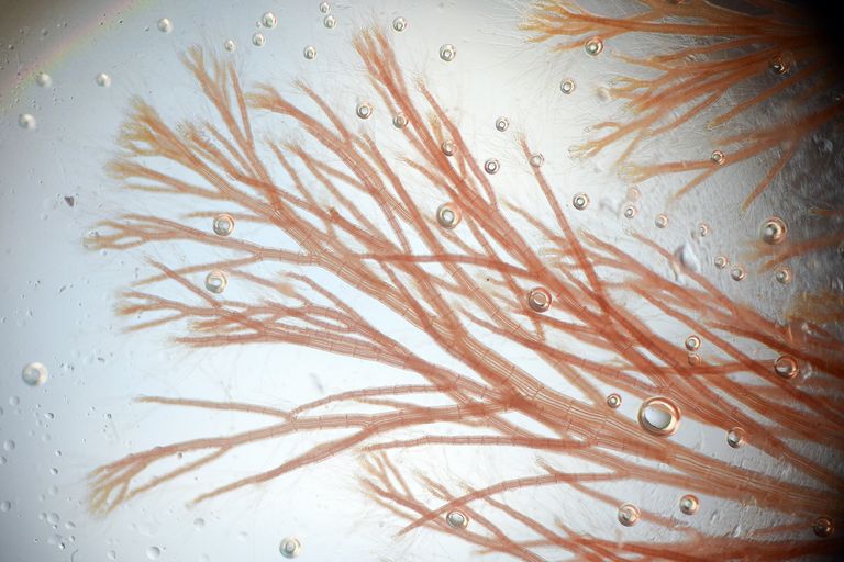 Анфельция складчатая (Ahnfeltia plicata) под микроскопом Анфельция складчатая (Ahnfeltia plicata) под микроскопом
