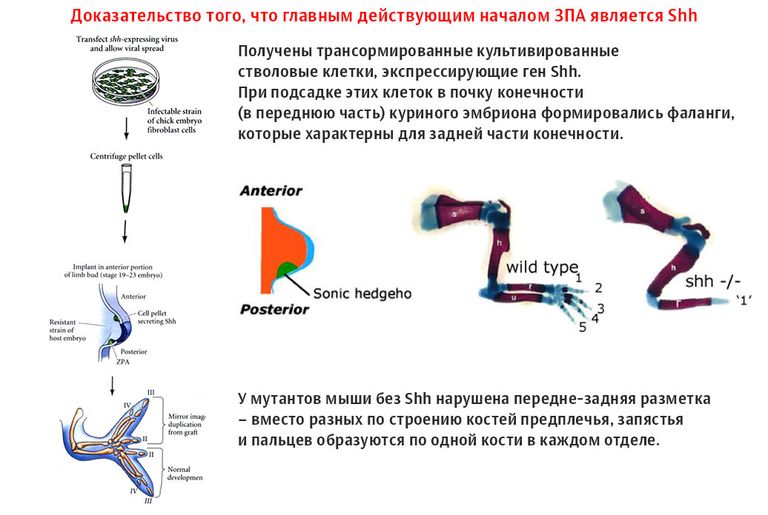 На слайде показаны конечности, которые сформировались при нарушениях в работе осей полярности На слайде показаны конечности, которые сформировались при нарушениях в работе осей полярности