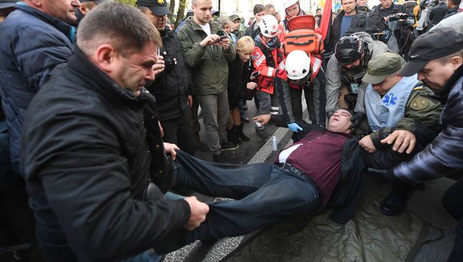 Пострадавший во время митинга в Киеве. 17 октября 2017 Пострадавший во время митинга в Киеве. 17 октября 2017