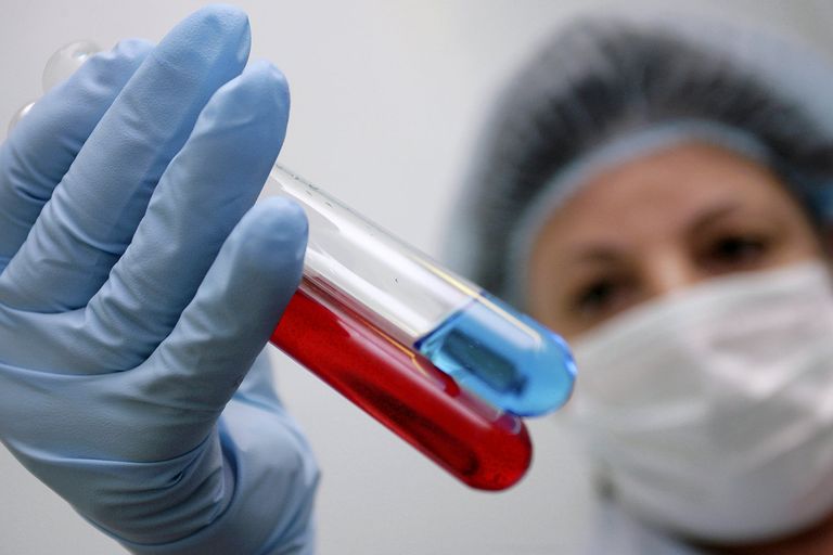 К заблуждениям можно отнести и то, что лечение от вируса иммунодефицита стоит заоблачных денег К заблуждениям можно отнести и то, что лечение от вируса иммунодефицита стоит заоблачных денег