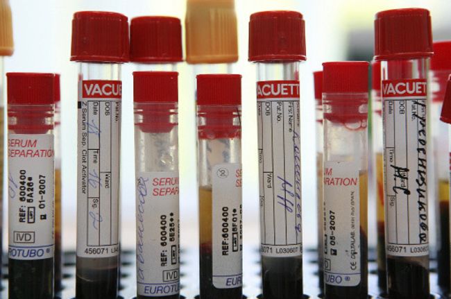 Определены генные характеристики первого российского вируса А/H1N1