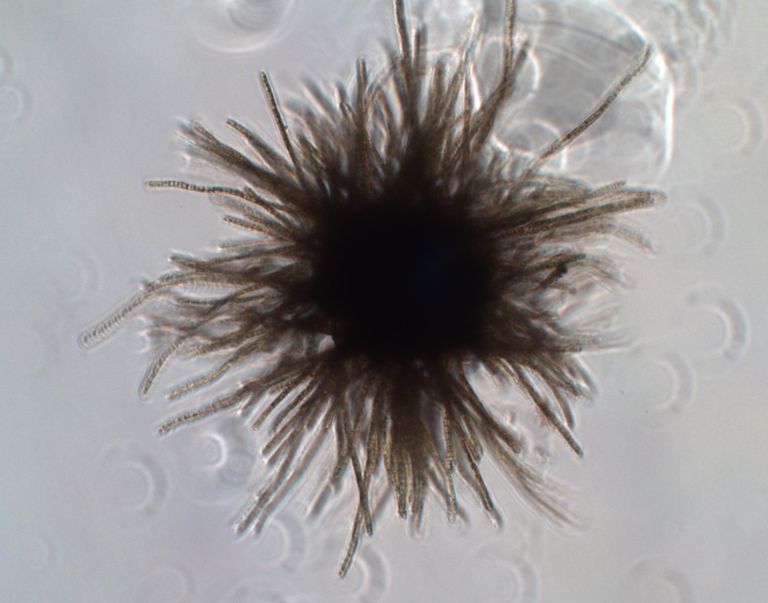 Бактерии Trichodesmium thiebautii