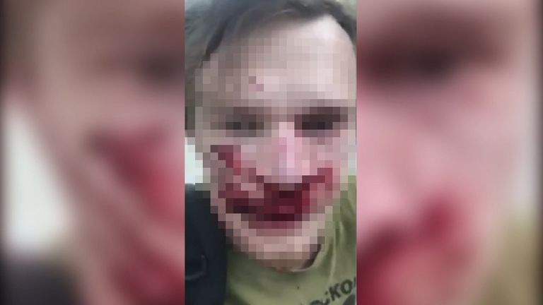 Миллеровские боксеры избивают авиаинженера из Ижевска Миллеровские боксеры избивают авиаинженера из Ижевска