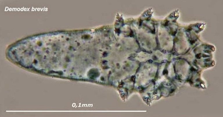 Demodex Brevis Demodex Brevis