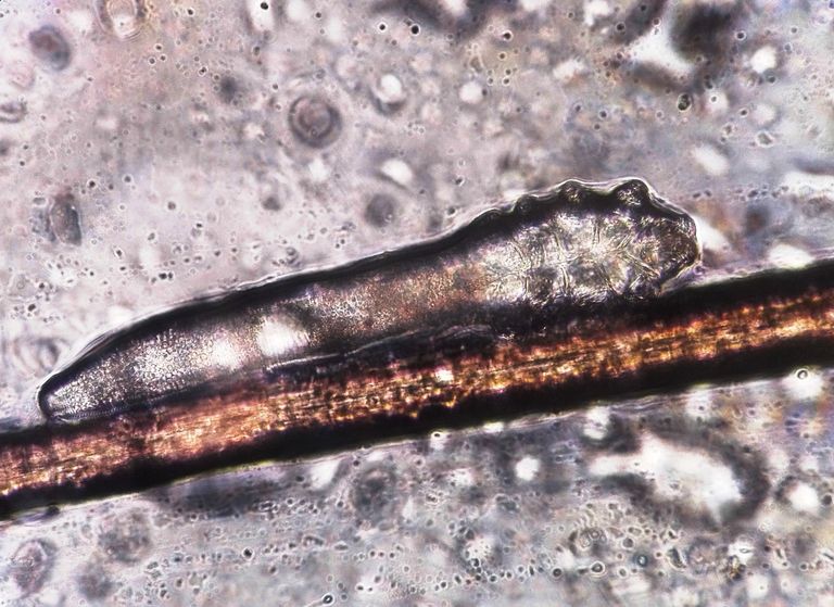 Demodex folliculorum Demodex folliculorum
