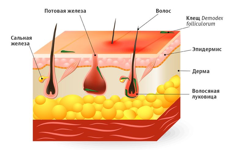 Клещи на коже человека Клещи на коже человека