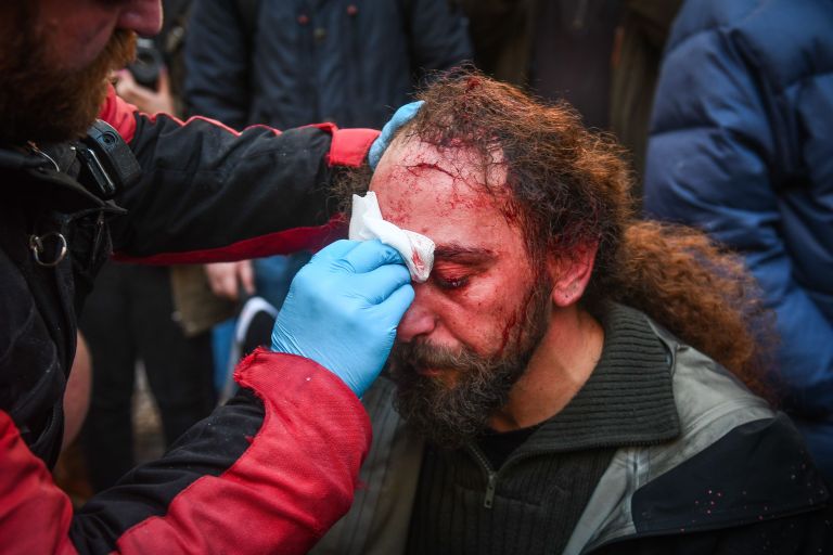 В Афинах в ходе протестов пострадал стрингер агентства Sputnik. 20.01.2019
В Афинах в ходе протестов пострадал стрингер агентства Sputnik. 20.01.2019