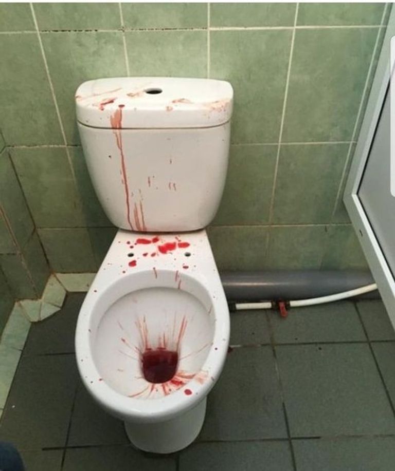 Унитаз в крови 