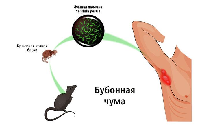 Бубонная чума Бубонная чума