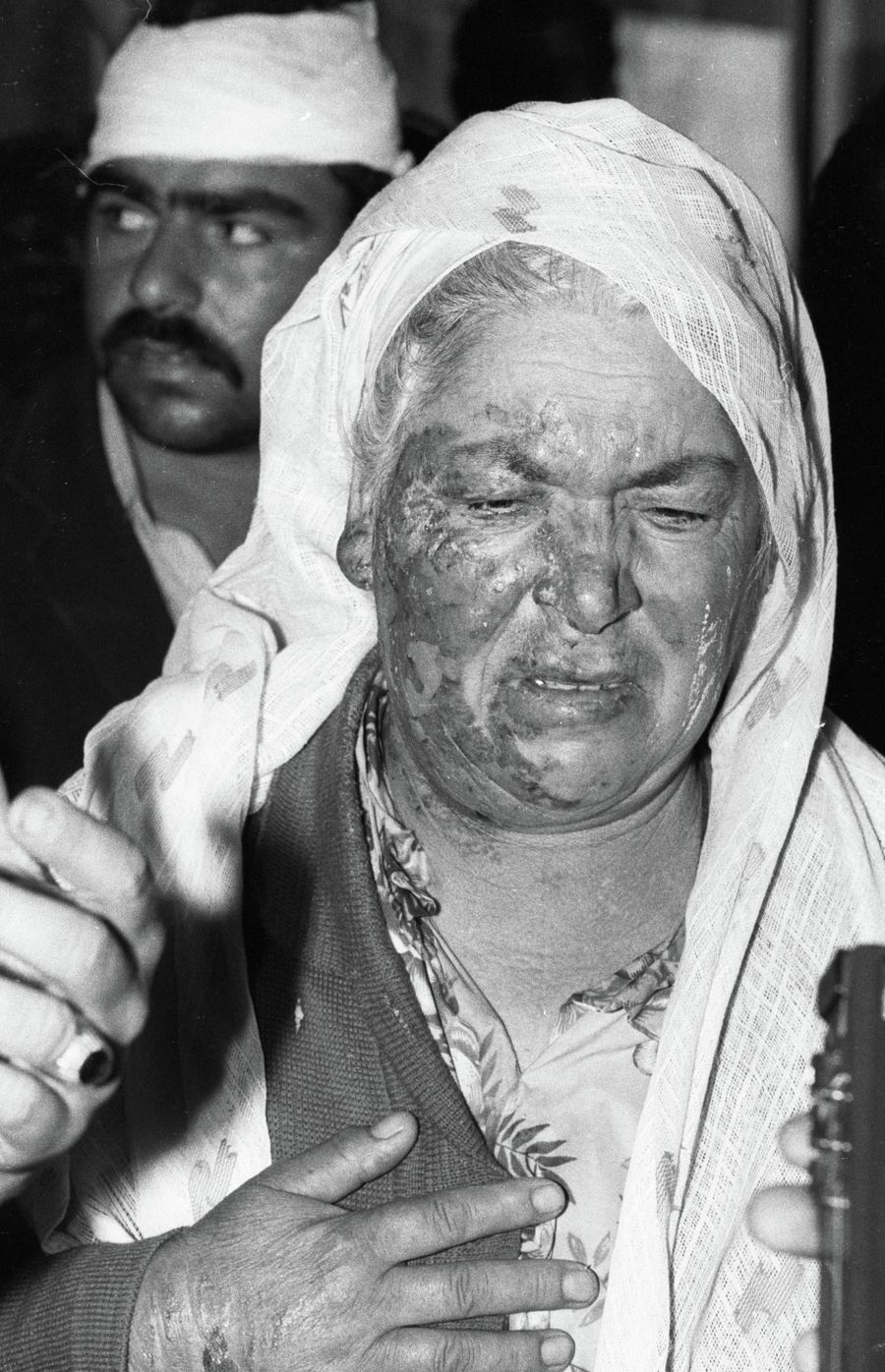 Женщина с окровавленным лицом - жертва столкновений на межнациональной почве Женщина с окровавленным лицом - жертва столкновений на межнациональной почве