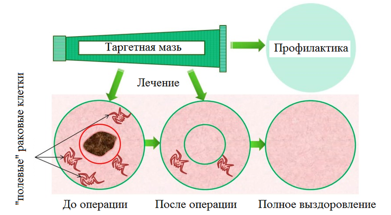 Схематическое изображение эффекта от применения подхода Схематическое изображение эффекта от применения подхода