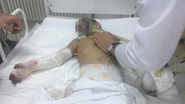 Девочка Аиша из Ингушетии после операции Девочка Аиша из Ингушетии после операции
