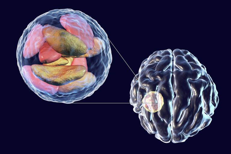 Токсоплазма Toxoplasma gondii Токсоплазма Toxoplasma gondii
