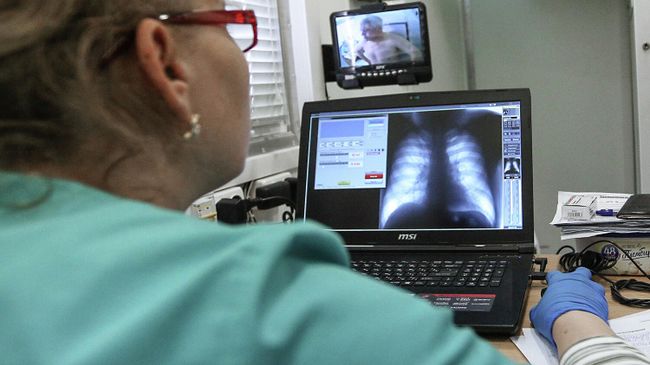 Врач рассматривает снимок грудной клетки пациента Врач рассматривает снимок грудной клетки пациента