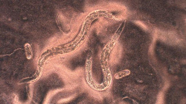Дьявольский червь (Halicephalobus mephisto) под микроскопом. Увеличение 200х Дьявольский червь (Halicephalobus mephisto) под микроскопом. Увеличение 200х