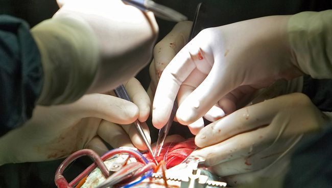 Операция на сердце Операция на сердце