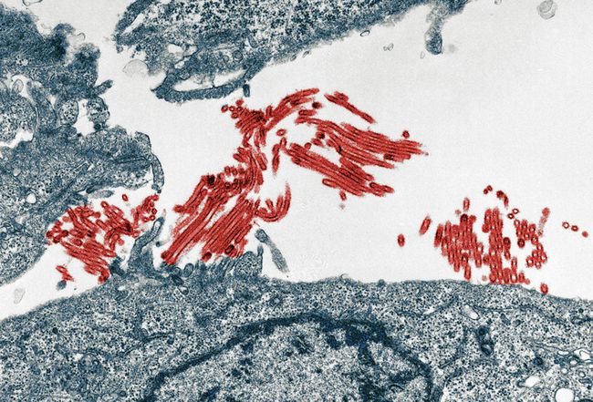 Великобритания поможет развивающимся странам в борьбе с гриппом A/H1N1
