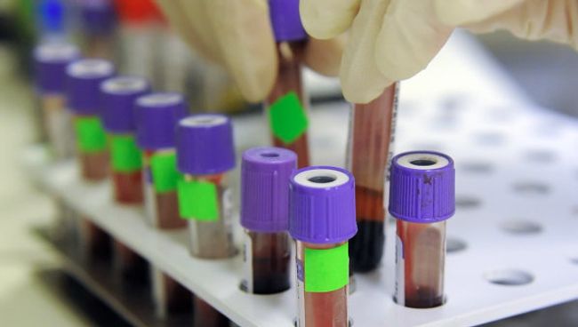 Грипп A/H1N1 не сдвинет начало учебного года в российских школах Грипп A/H1N1 не сдвинет начало учебного года в российских школах