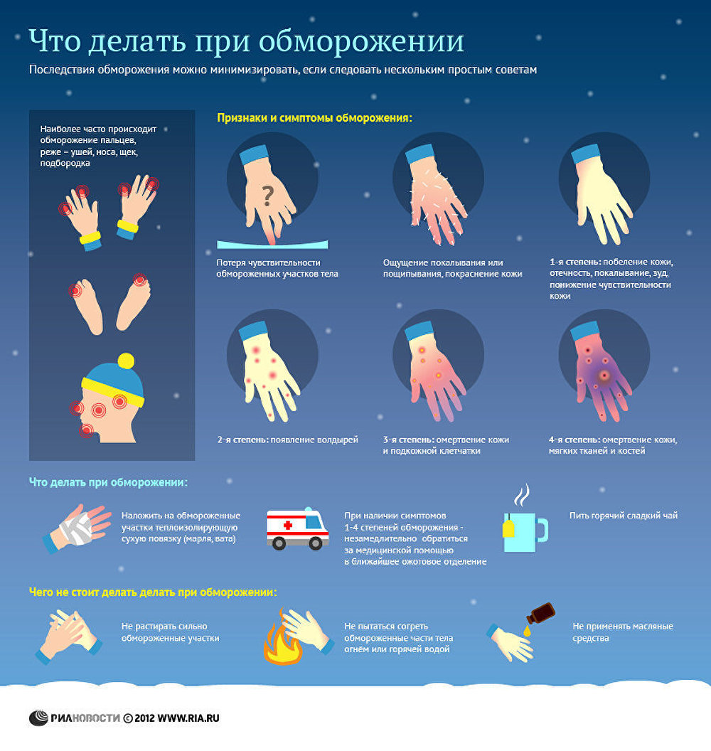 Что делать при обморожении. Инфографика Что делать при обморожении. Инфографика