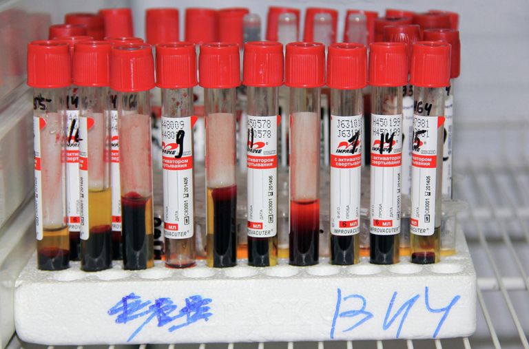 Ампулы с кровью. Клиенты томского центра Анти-СПИД сдали кровь на ВИЧ-инфекцию