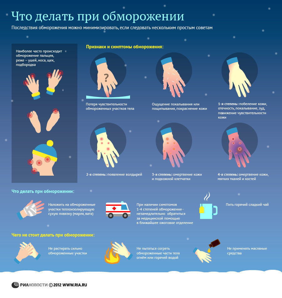 Что делать при обморожении Что делать при обморожении