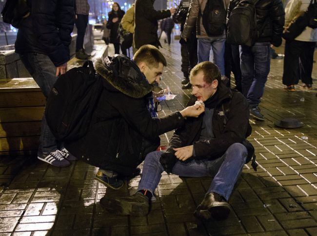 Одиннадцать болельщиков французского футбольного клуба Сент-Этьен были госпитализированы после нападения фанатов днепропетровского Днепра Одиннадцать болельщиков французского футбольного клуба Сент-Этьен были госпитализированы после нападения фанатов днепропетровского Днепра