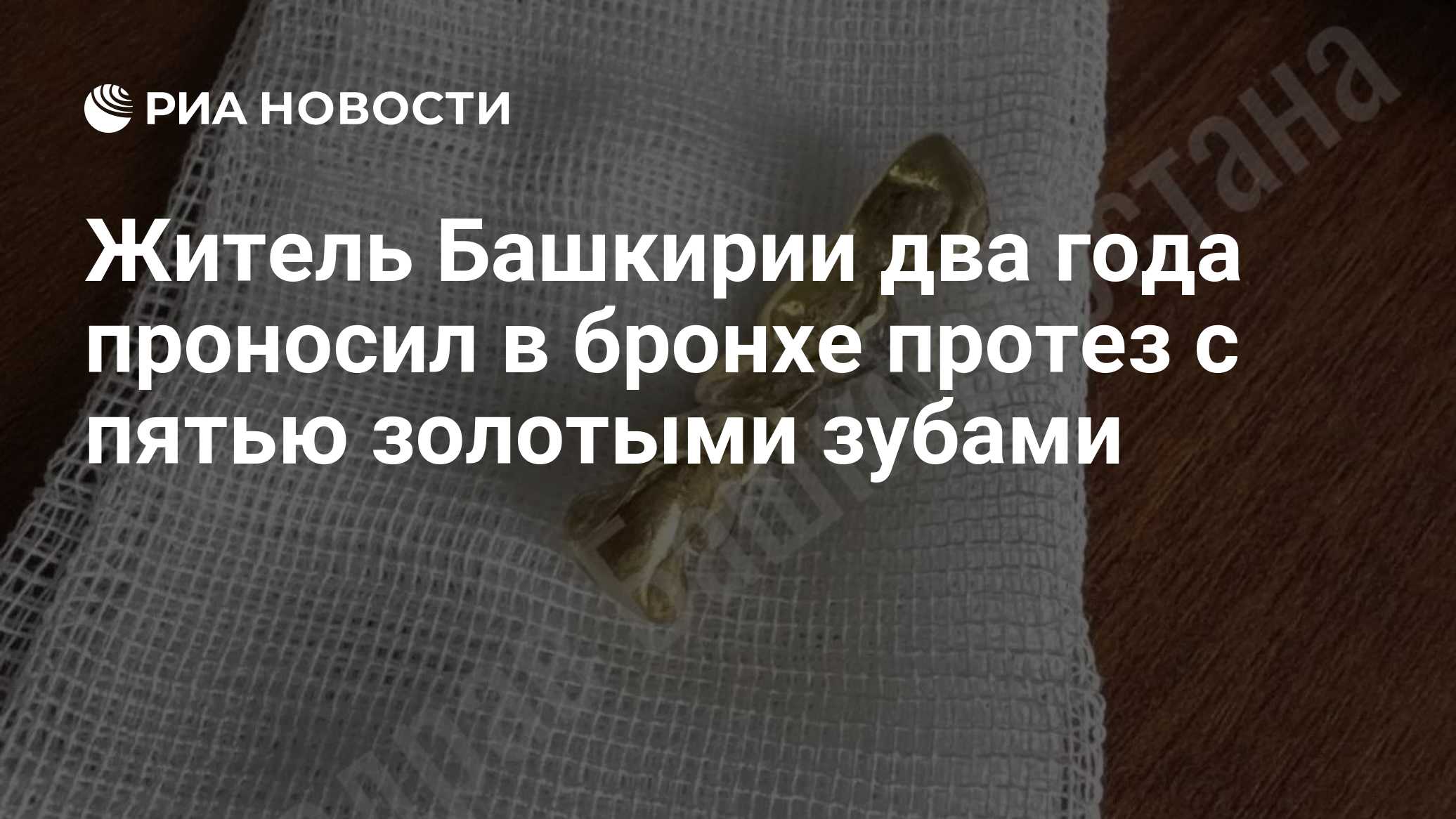 Житель Башкирии два года проносил в бронхе протез с пятью золотыми зубами
